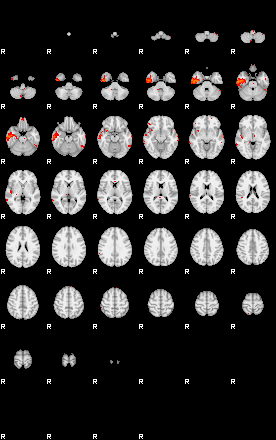 Patients 28676 3