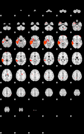 Patients 28771 98