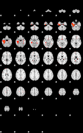 Patients 28810 4