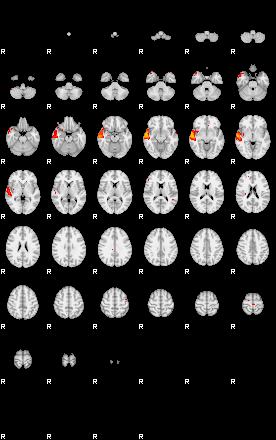 Patients 29060 148