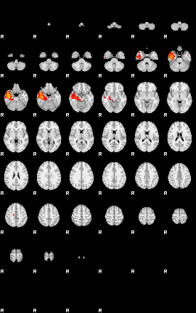 Patients 29070 3