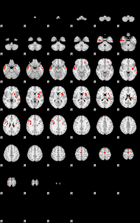 Patients 29175 64