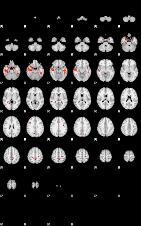 Patients 29185 133