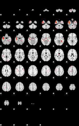 Patients 29221 3