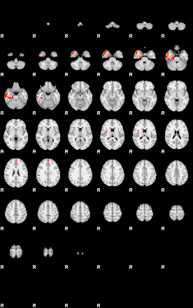 Patients 29413 162