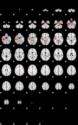 Patients 29733 4