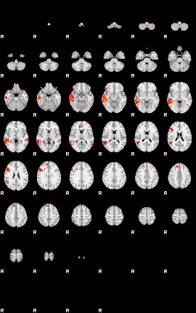 Patients 30014 95