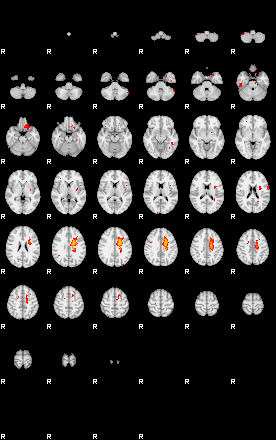 Patients 29041 4