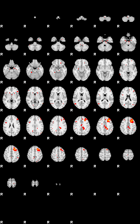 Patients 30180 175