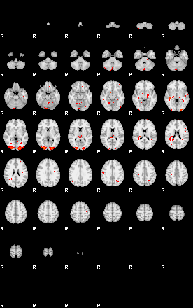 Patients 29008 89