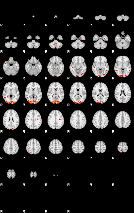 Patients 29009 18