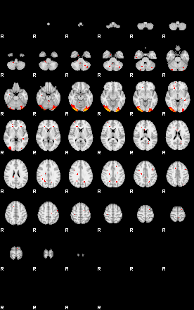 Patients 29160 87