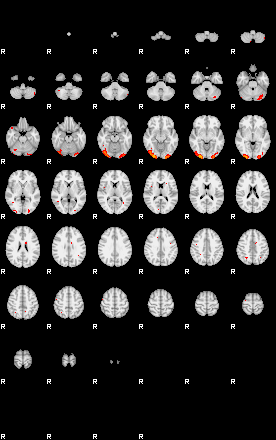 Patients 29184 75