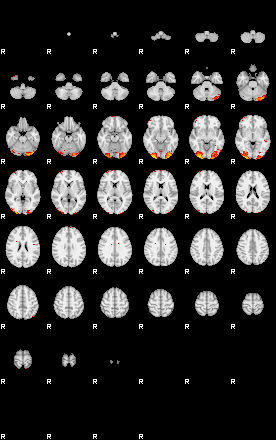 Patients 29575 77