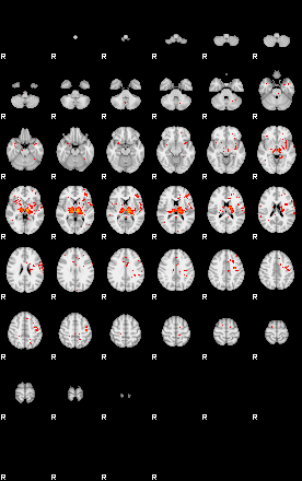 Patients 28930 142