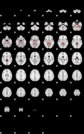 Patients 28933 23