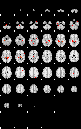 Patients 28935 93