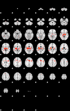 Patients 28992 135