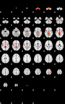 Patients 29052 161