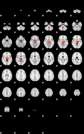 Patients 29059 126