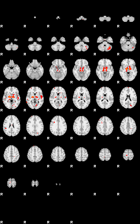 Patients 29096 128