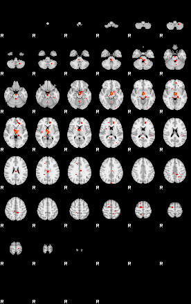 Patients 29160 50