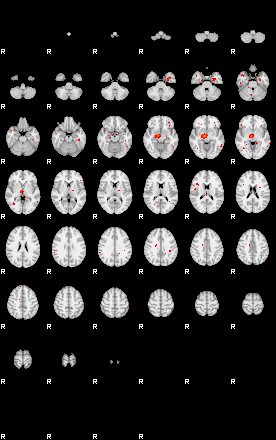 Patients 29172 186