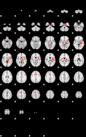 Patients 29182 132