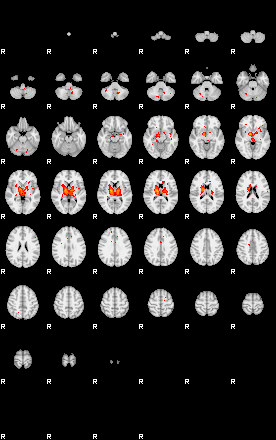 Patients 29201 88