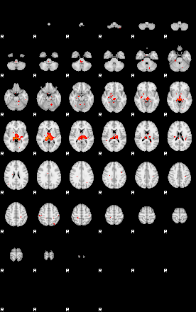 Patients 29210 100