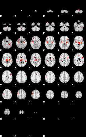 Patients 29212 52