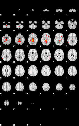 Patients 29280 43