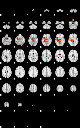 Patients 29293 54