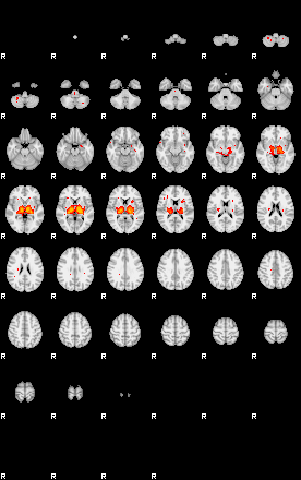 Patients 29416 134