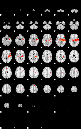 Patients 29503 125