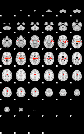 Patients 29510 125