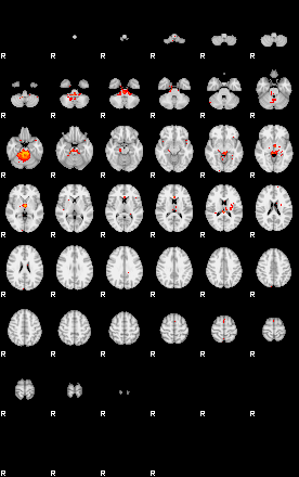 Patients 29540 90