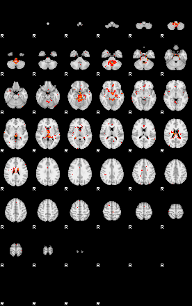 Patients 29545 13