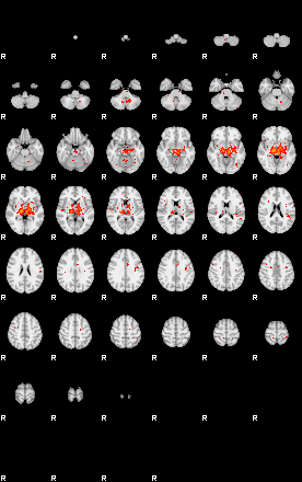 Patients 30017 150