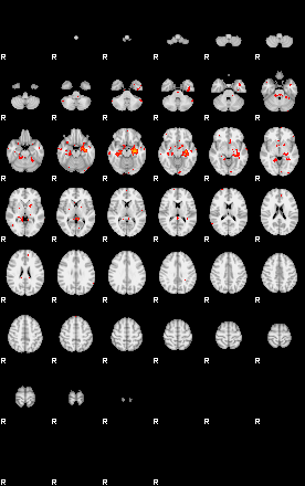 Patients 29042 95