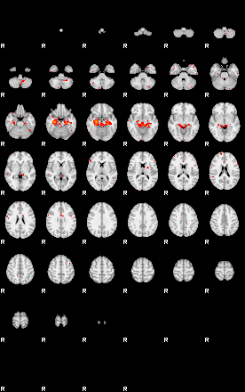 Patients 29043 131