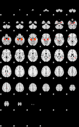 Patients 29066 98