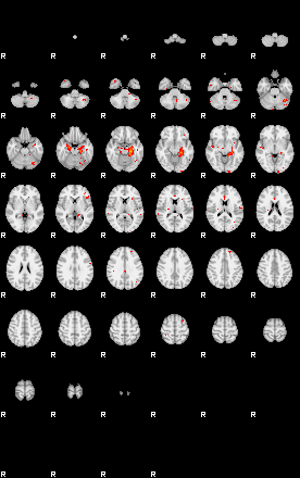 Patients 29097 35