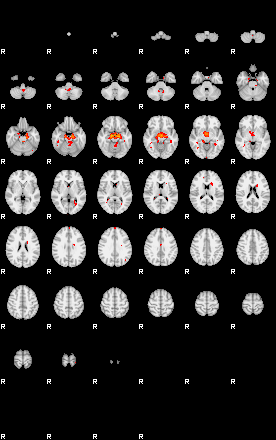 Patients 29109 43