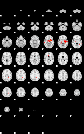 Patients 29156 154