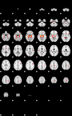 Patients 29161 82