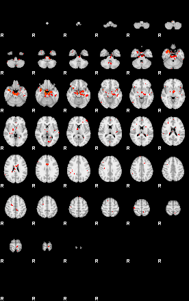 Patients 29191 4