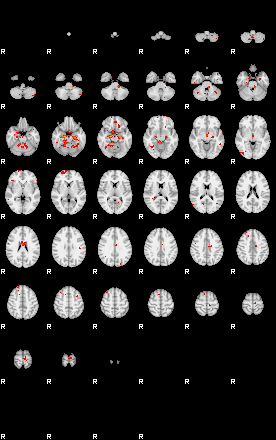 Patients 29207 95