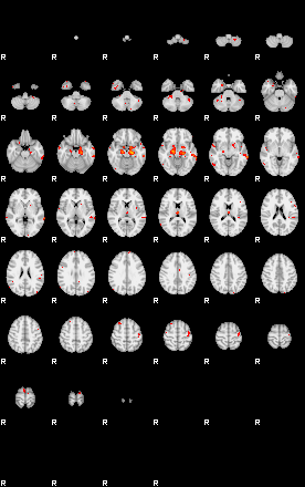 Patients 29291 94