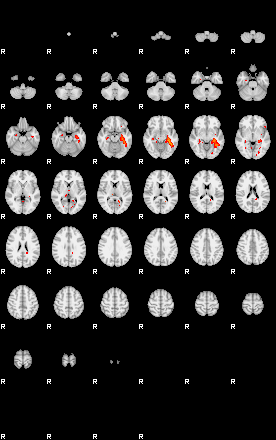 Patients 29430 195